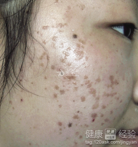 �������Ʊ�ƽ��󲹾Ȱ취