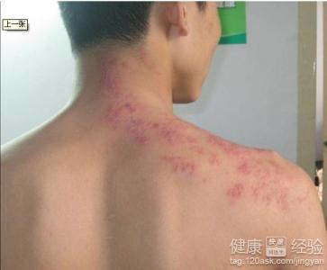 ��ҩ��ϴ�����Ʊ�ƽ�ಽ��,�Լ�ע������