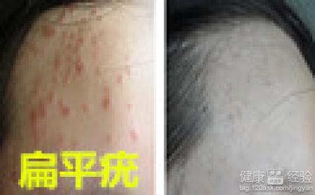 ���ϳ��˺ܶ��ƽ�࣬��֪����������ȥ����