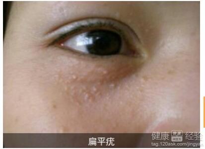 ����ʶ���ƽ�࣬�ܷ�������Ӧע����Щ