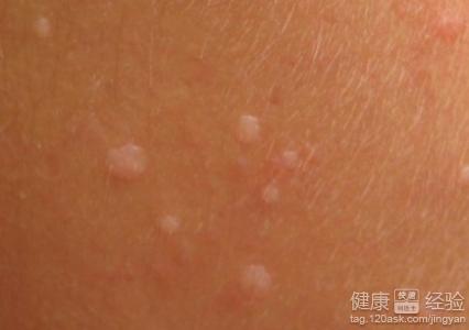 �����б�ƽ����ô���ϲ���ѡ�񷽷�