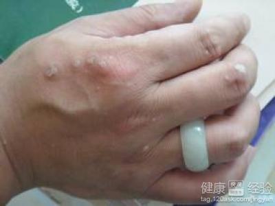 第1步