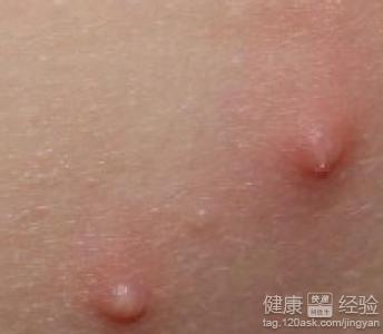 ��������ҩ���ĸ��ʺϴ�Ⱦ������