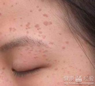 �沿��ƽ����ʲôҩ���