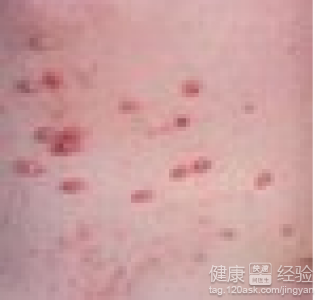 ��ҩ�ڼ��ƽ��������ɫʲôԭ����