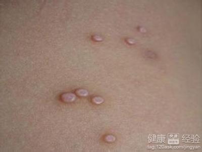 ���˴�Ⱦ���������ʳ����