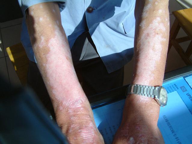 点击查看源网页