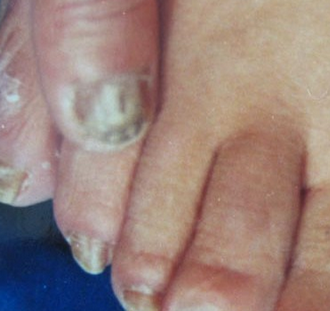 ��ָ�׷ּ���