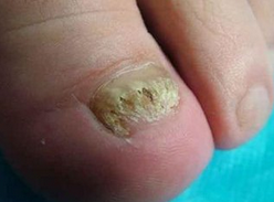 ���ϻ�ָ�׵�Σ��