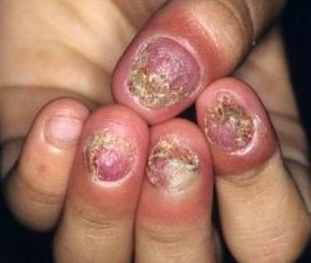 ��ָ����ô��Ⱦ��