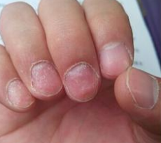 ��ָ�׶������Σ��