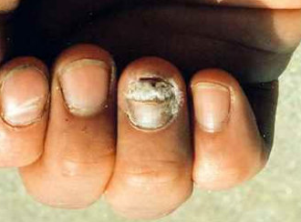 ��ָ�ײ��κ������