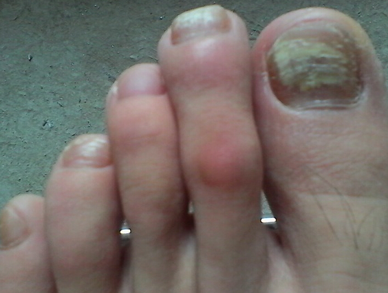 ��ָ����ô�ž���Ⱦ