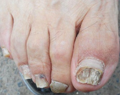 ���ϳ���ָ��ע��ʲô