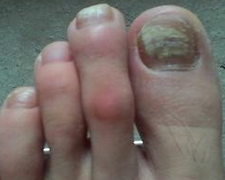 ��η�ֹ��ָ�״�Ⱦ