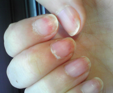 ��ָ�׵Ĵ�Ⱦ��