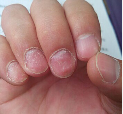 �����շ���ָ����