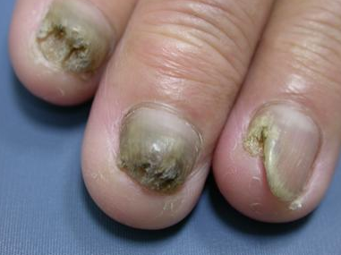 �ͻ�ָ�׵������ֻᴫȾ��