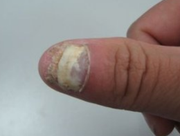 ��ָ�������ܴ�Ⱦ����