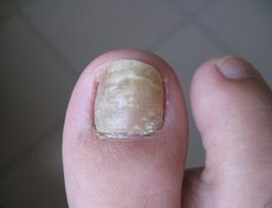 ��ָ�׻ᴫȾ��������