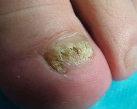 ���ϵĻ�ָ����ɶΣ��