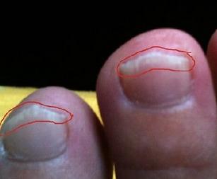 ��ָ�׶������к���