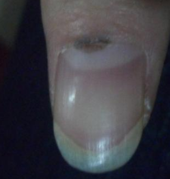 ��ôԤ����ָ�״�Ⱦ������