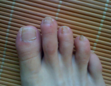 ��ָ�׻᲻���Լ���