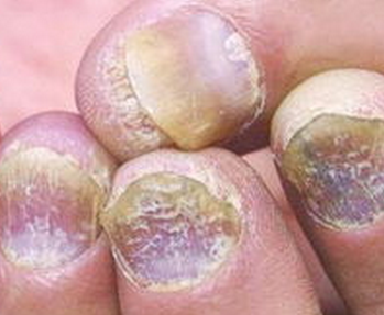 ��ָ�����״�Ⱦ��