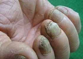 ��ָ�״�Ⱦ������