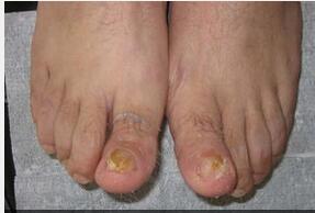 ��ָ�׵Ĵ���;��