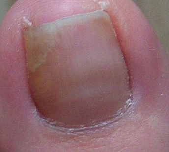 ��ָ�״�Ⱦ����