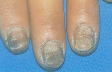 ��ָ����ô���δ�Ⱦ