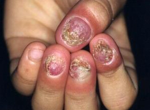 ��ָ�׻᳤������