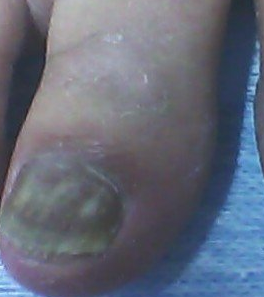 ��΢��ָ�����κ���