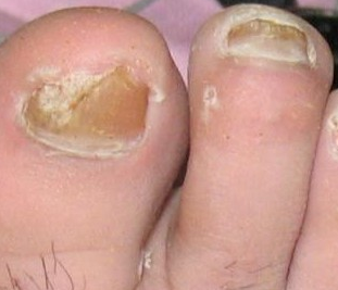 ��ָ�׳�ʲôʳ���