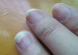 ��ָ�׻�Σ��������