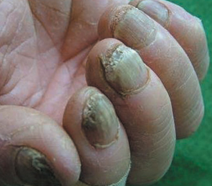 ��ָ�״�Ⱦ���ٶ�