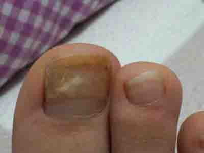 ��ָ�׿����ô�����