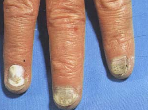 ��ָ�׶������Σ������Щ