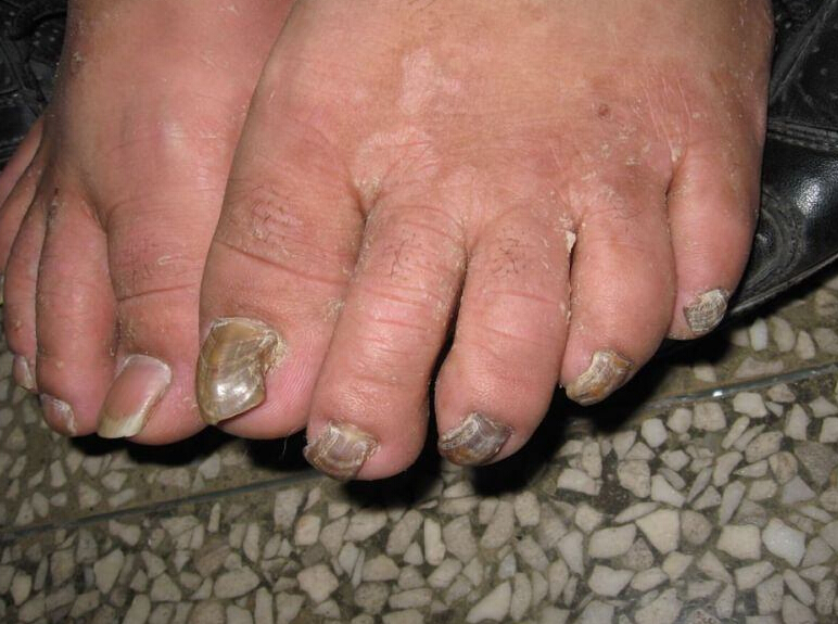 ��ָ�׻�����