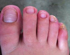 ��ָ���ܴ�Ⱦ������ô