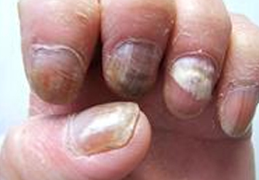 ��ָ�׵����غ��