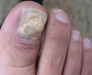 ��ָ���Ƿ�Ⱦ����