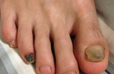 ��ָ�׶������Σ��