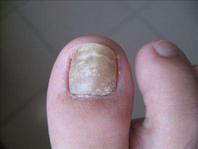 ��ָ�׻ᴫȾ������