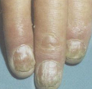 �������ָ��