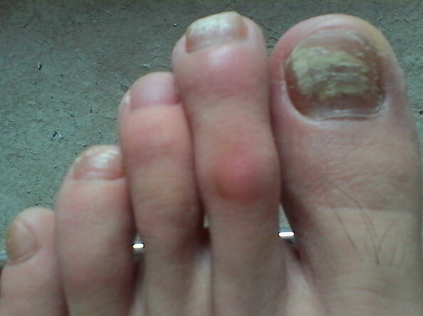 ��ָ��ͨ��ʲô��Ⱦ��