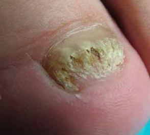 ��ָ�׻���ô