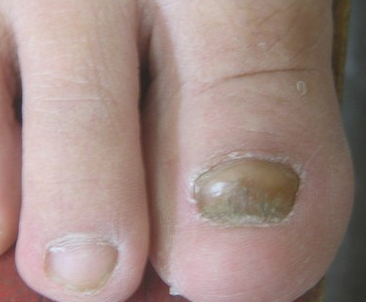 ��ָ���״�Ⱦ������ô